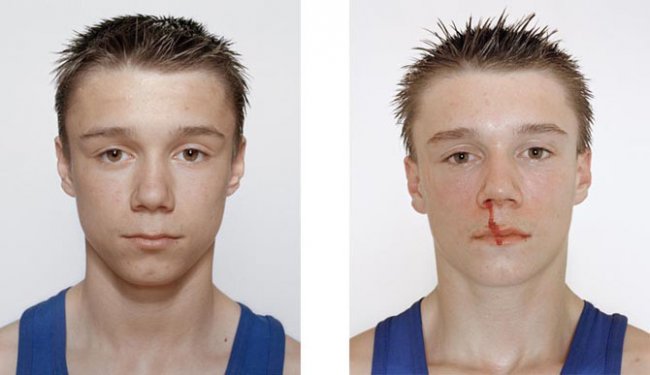 Юные боксеры: до и после боя