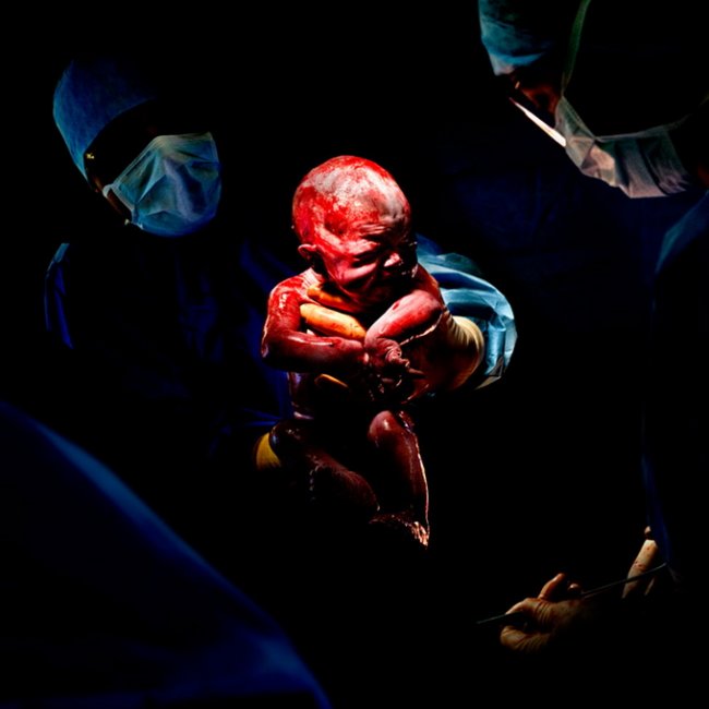 Новорожденные в первые секунды жизни